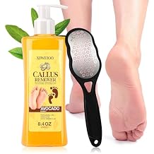 Foot Callus Remover Gel Kit Foot Files Set Heell Exfoliator Dead Skin Remover Pedicure Foot Spa Products Home Pedicure Foot Spa Supplies for Rough, Dry, Cracked Skin